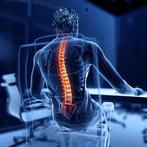 Physiotherapy